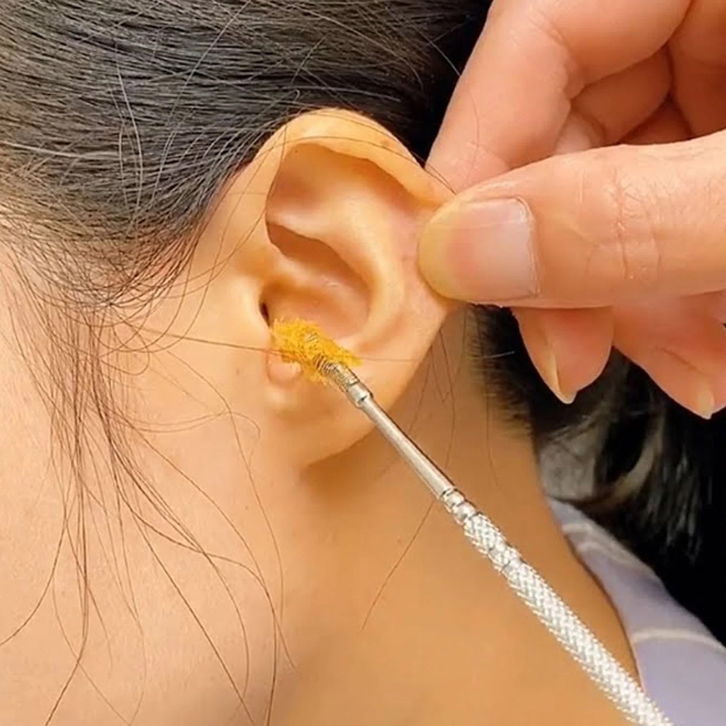 Ear Wax Removal Kit